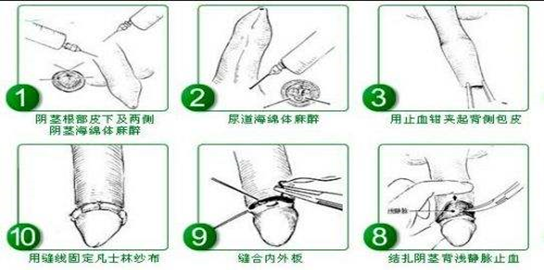 深圳割包皮最好的醫院，就在羅湖區這家！2