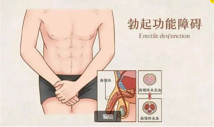 深圳看(治)陽痿最好的醫院，是哪一家？1