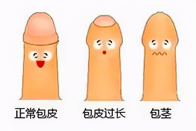 深圳割包皮最便宜的醫院，價格不到1000元!2