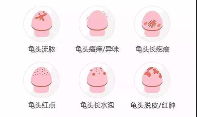 為什麼男性會發生龜頭炎？怎麼治療的？2