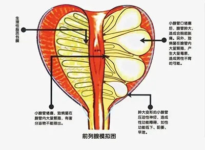 深圳前列腺痛怎麼治療好？2