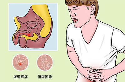 深圳尿道炎可以治愈嗎？如何防止復發？