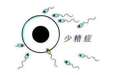 深圳男性少精癥可以懷孕嗎？怎麼治療？1