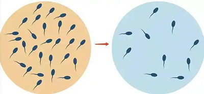 深圳男性少精癥可以懷孕嗎？怎麼治療？2